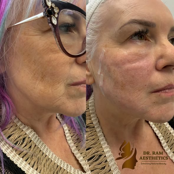 Jawline & Skin Quality — Profile